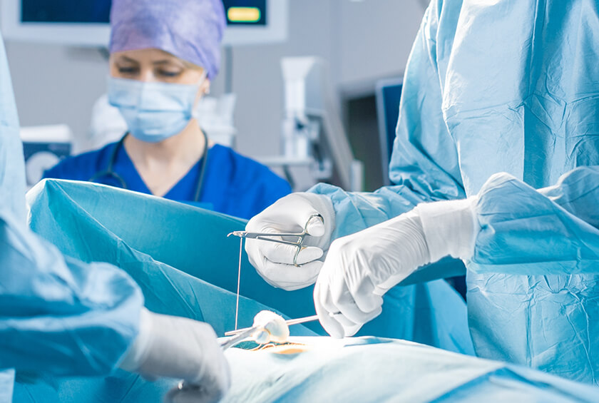 Controlled rotary cutting mechanism